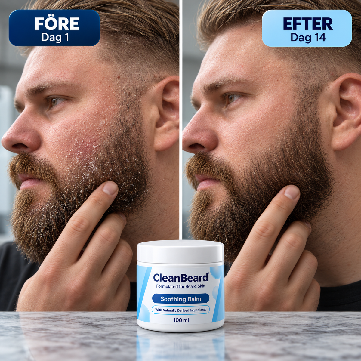 CleanBeard™ - Lugna klådan, motverka mjället & behåll skägget